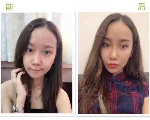 可以变成婴儿脸的软件大全-把脸变成童颜的app合集-一键变婴儿脸的app排行榜